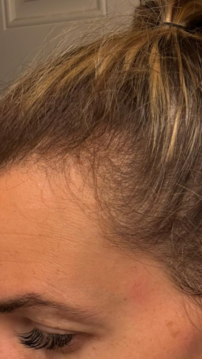 Before using product