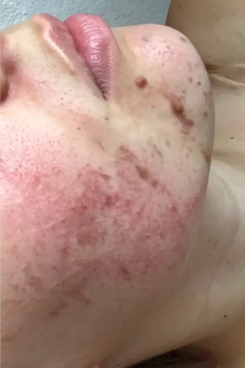 Before using product