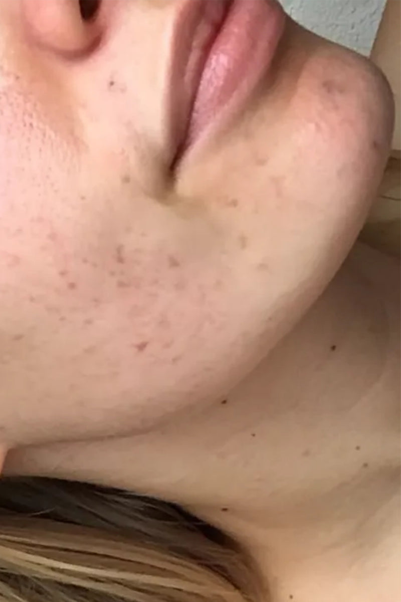 After using product