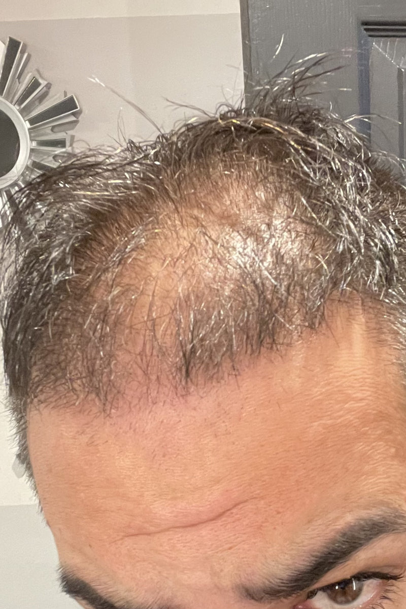 Before using product