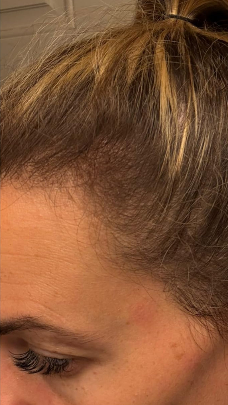 After using product